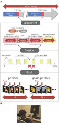 Visualizing Neuropharmacological Effects of Guanfacine Extended Release in Attention Deficit Hyperactivity Disorder Using Functional Near-Infrared Spectroscopy